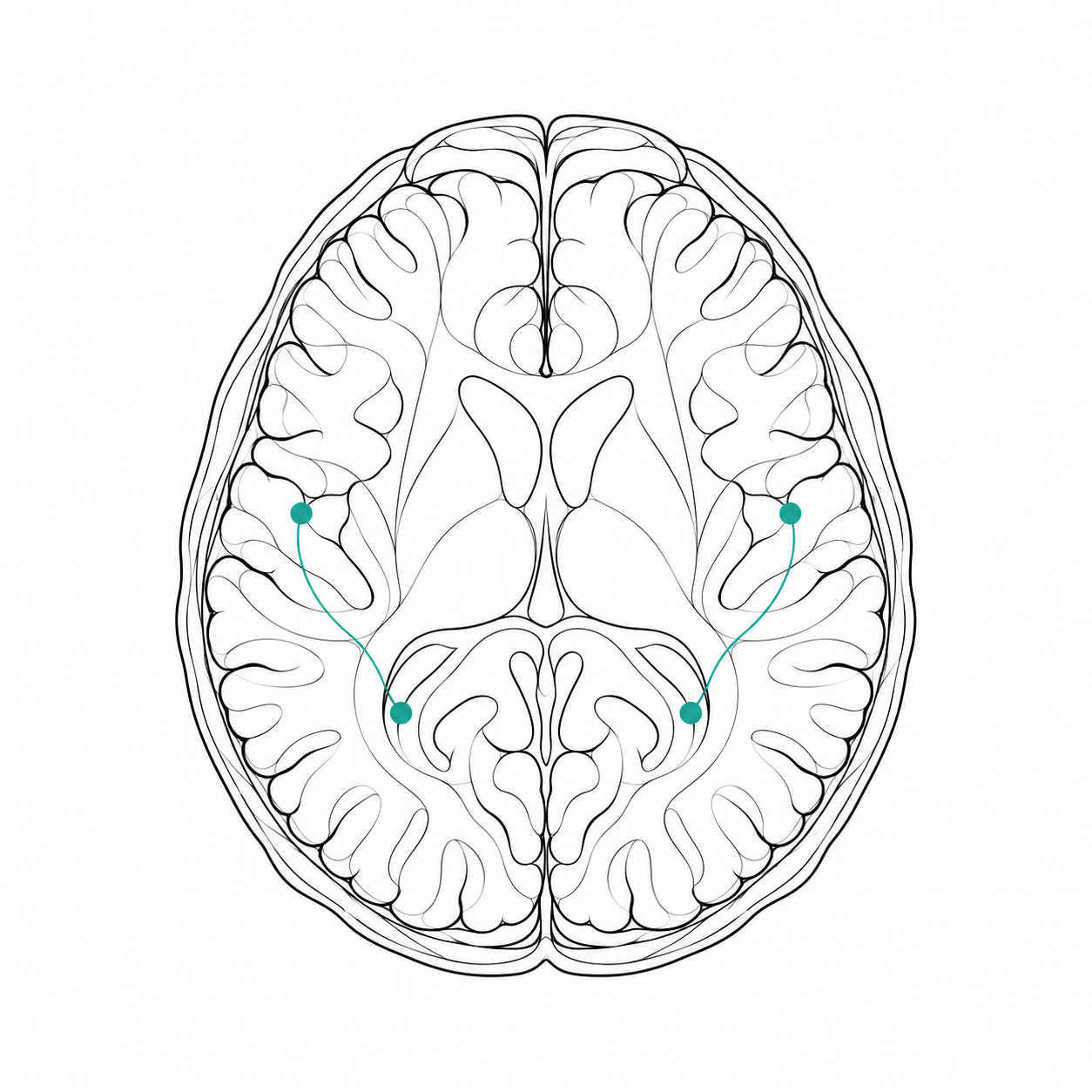 Digital brain illustration with black wireframe lines and turquoise accents.
